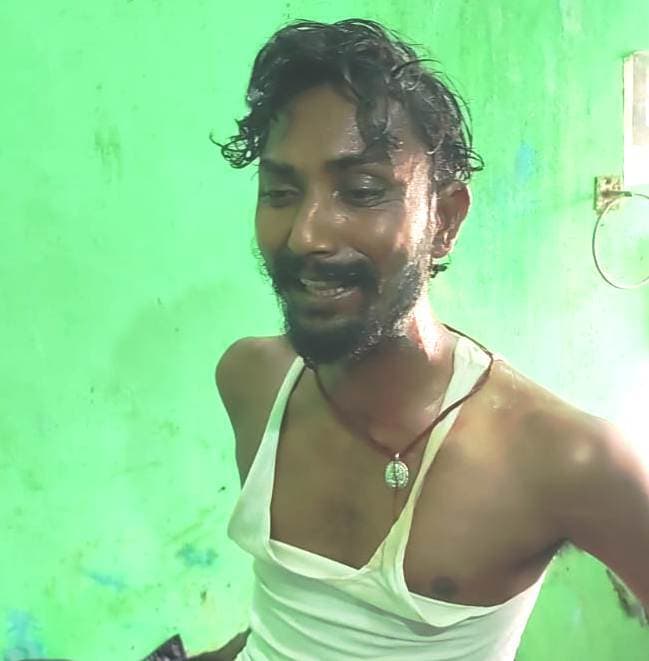 Bhagalpur news गरम तेल युवक पर फेंका, गंभीर रूप से जख्मी का चल रहा इलाज