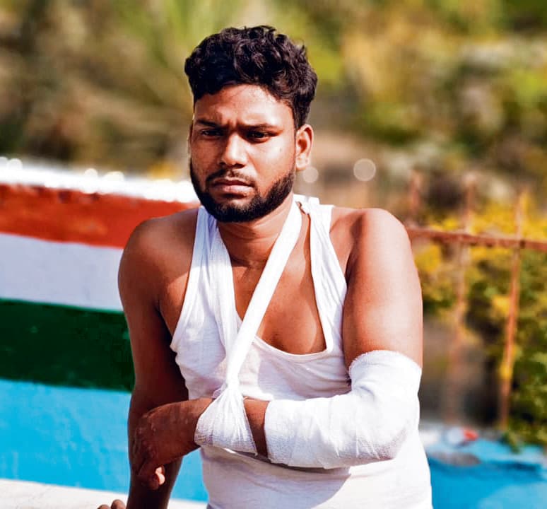 Gopalganj News : बड़हरा में बंधक बने युवक को मुक्त कराने गयी पुलिस टीम पर हमला, लाठीचार्ज और पथराव में 23 घायल