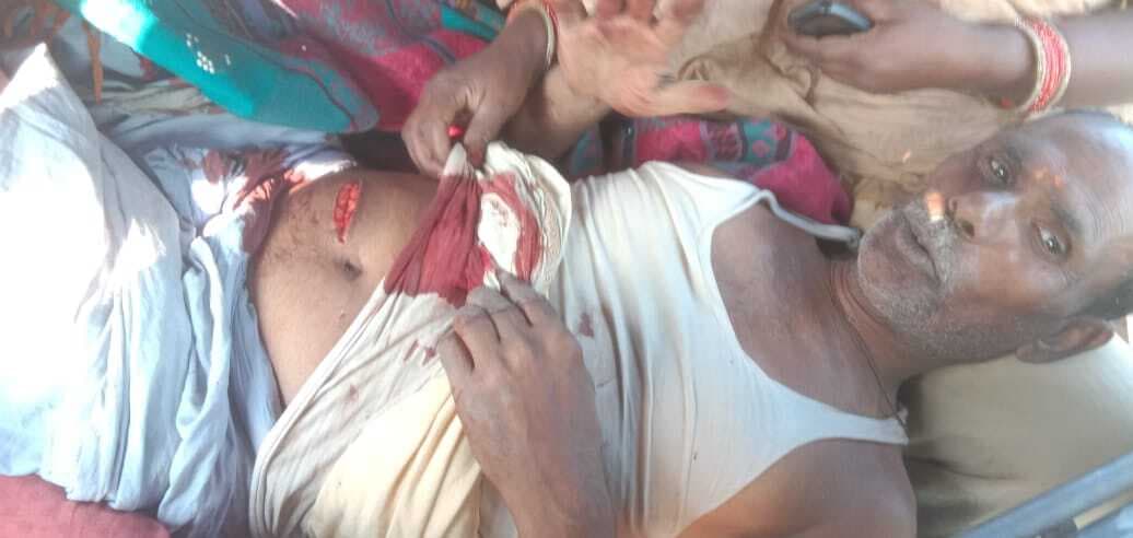 पुरानी रंजिश को लेकर धारदार हथियार से किया जख्मी, रेफर