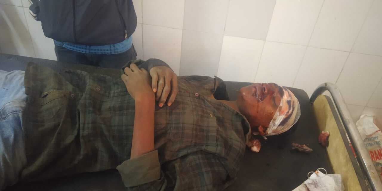 Accident : राह चलते युवक को बाइक सवार ने मारी टक्कर, तीन जख्मी