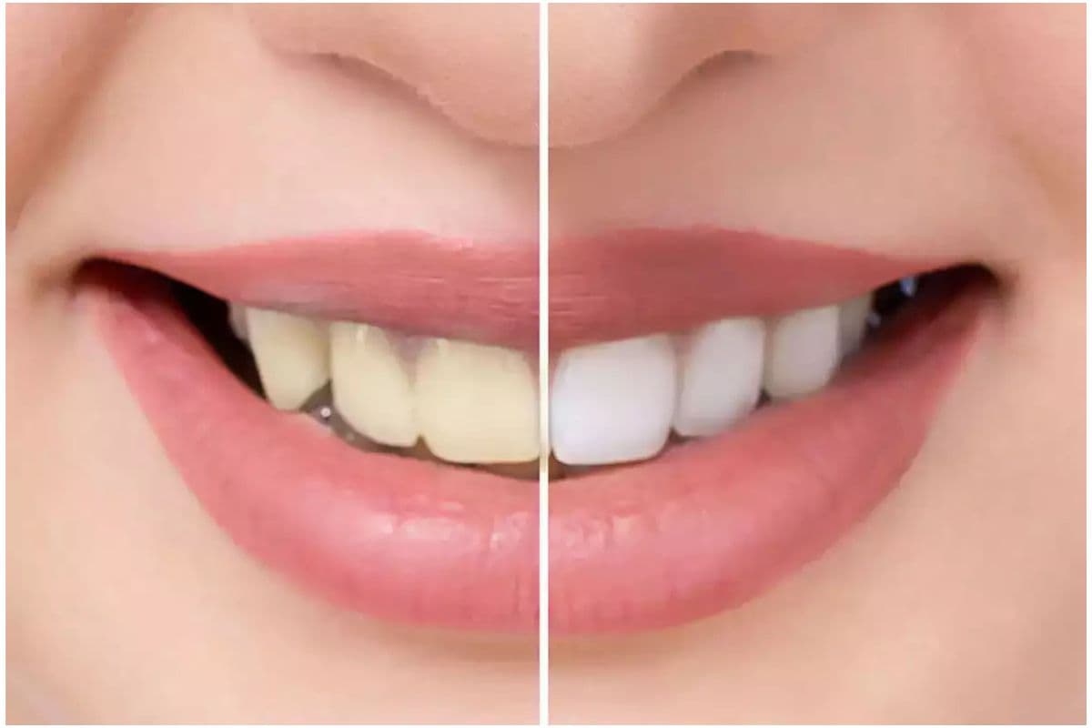 केमिकल टूथपेस्ट को कहें अलविदा,पीले दांत और बदबू से निजात दिलाएंगे ये 5 आयुर्वेदिक मंजन