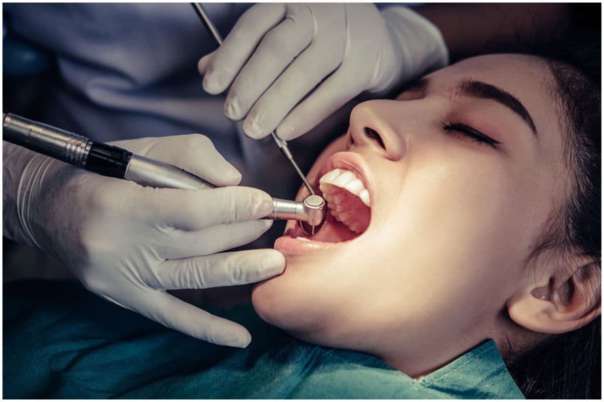 Cavity Home Remedies : दांतो में कैविटी से छुटकारा पाने के लिए बस लगा लें ये चीजें, चमक उठेगं आपके दांत