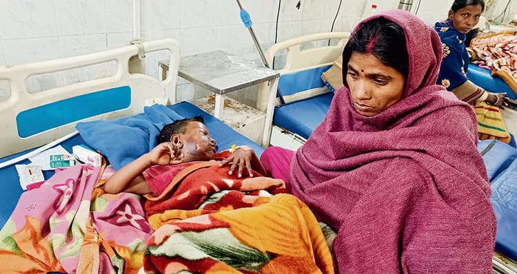 Gaya News : पांच साल के बच्चे को पेट्रोल छिड़क जलाया, चौकीदार के बेटे पर आरोप