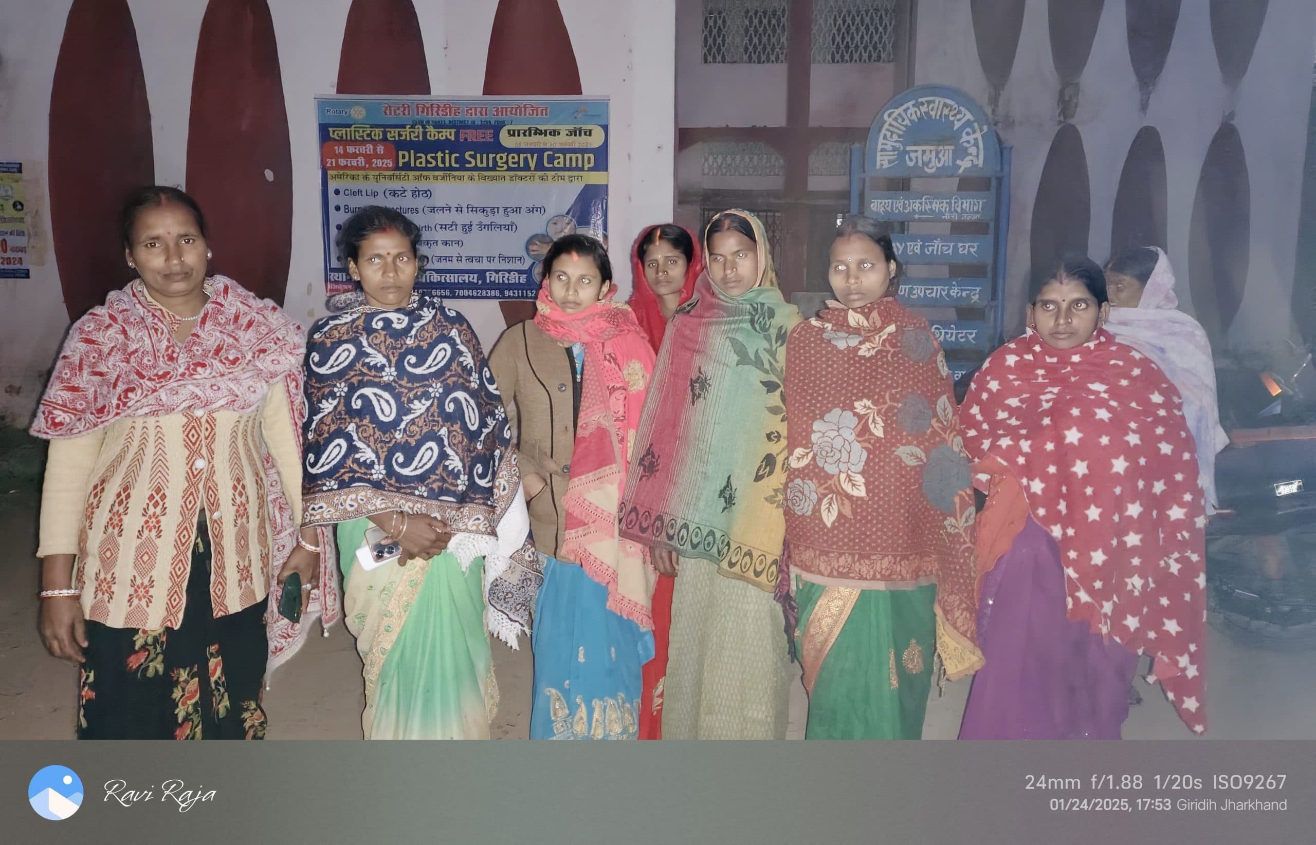 Giridih News: महिलाओं को बुलाकर दिनभर भूखे पेट बैठाये रखा, शाम में बोला गया नहीं होगा ऑपरेशन