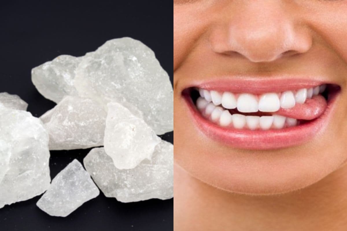 Alum for Dental Health: दांतों के लिए वरदान है फिटकिरी, जानें इसके फायदें
