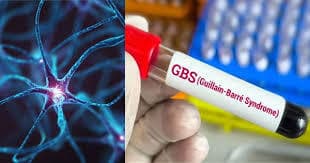 Health News : गुइलेन-बैरे सिंड्रोम की संदिग्ध दोनों बच्चियों की स्थिति में सुधार