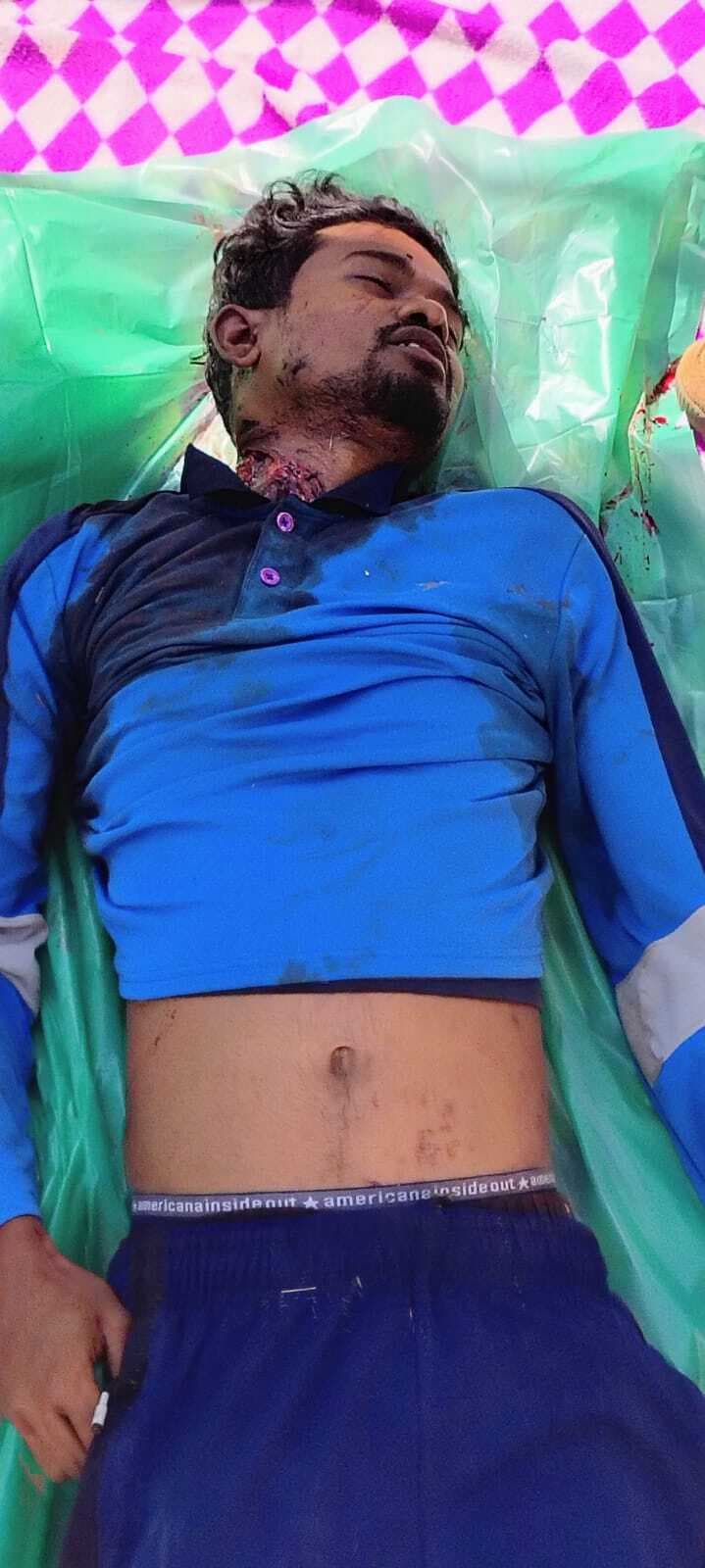 Chaibasa News : शादी समारोह से लौट रहे युवक की सड़क हादसे में मौत, साथी गंभीर