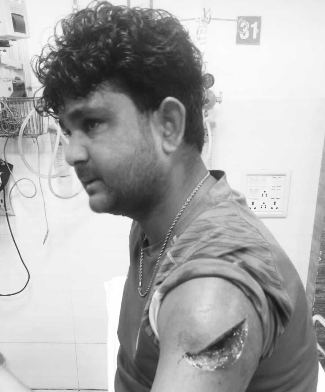 Jamshedpur News : बिष्टुपुर : बाइक की किस्त जमा नहीं करने पर कलेक्शन एजेंट ने चापड़ से किया हमला, एक गिरफ्तार