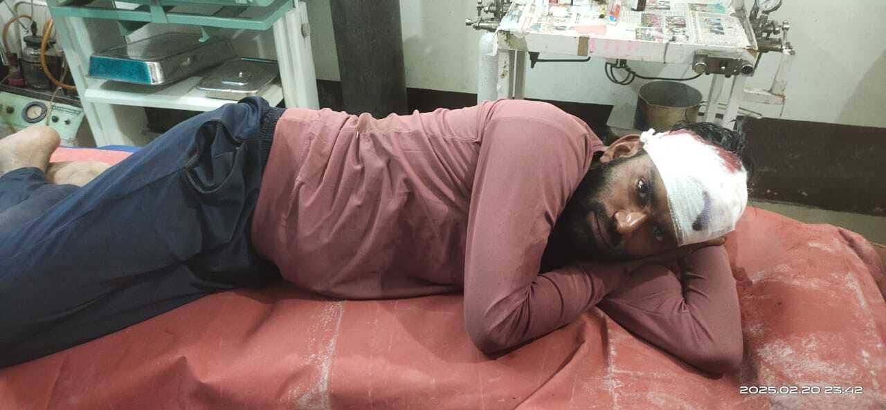 Dhanbad News: उधार नहीं देने पर दुकानदार का सिर फोड़ा