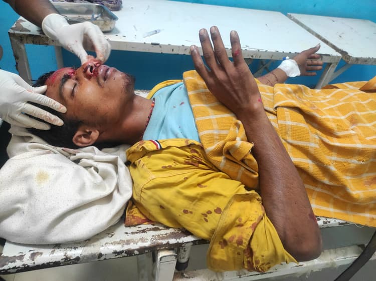 ट्रक की ठोकर से परीक्षा देने जा रहे बाइक सवार तीन छात्र जख्मी, एक गंभीर