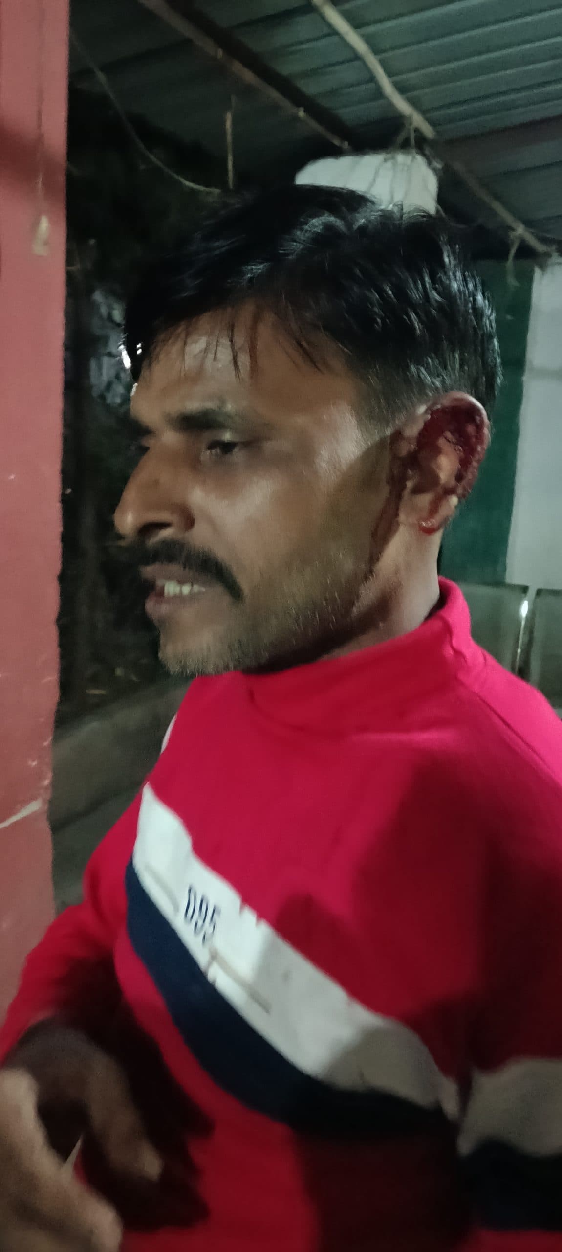 Dhanbad News : भूली में भांजे ने मामा पर की फायरिंग, कान जख्मी