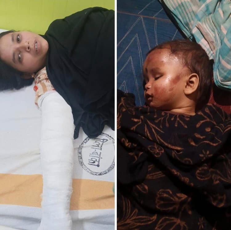 सड़क दुर्घटना में शिक्षिका गंभीर रूप से जख्मी, पुत्री की हुई मौत