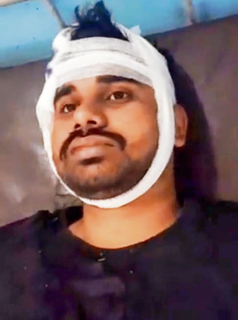 Buxar News: हमलावरों ने छात्र से चेन और नकद छीने, विरोध करने पर किया लहूलुहान