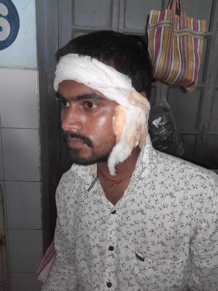 चाकू के हमले से युवा घायल, थाने में दिया आवेदन