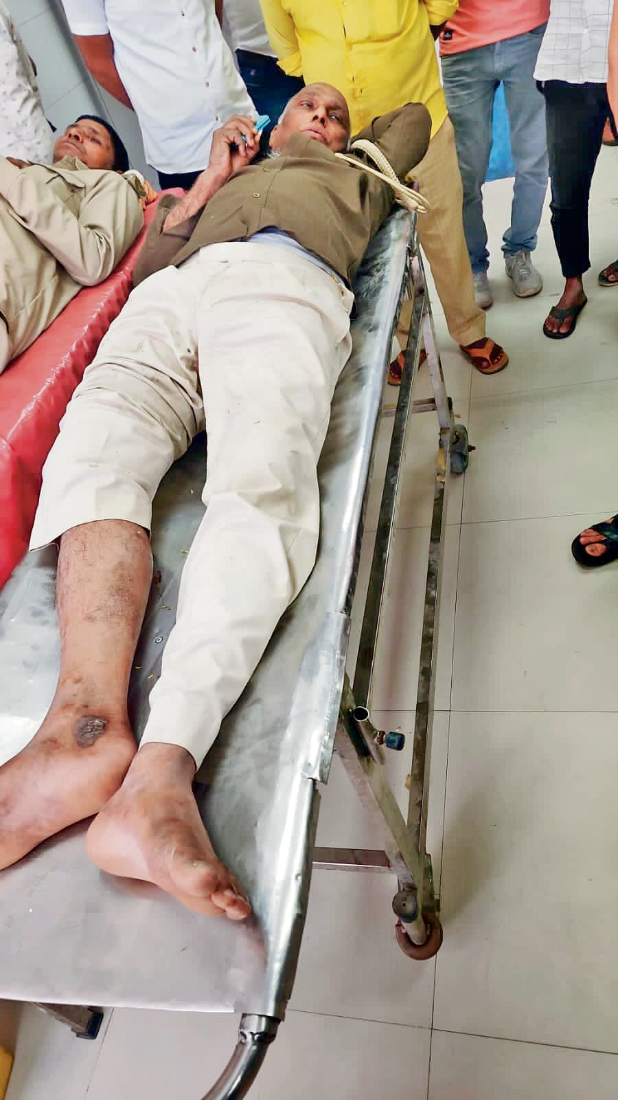 अनुसंधान करने जा रहे दारोगा और चौकीदार को कार सवार ने कुचला