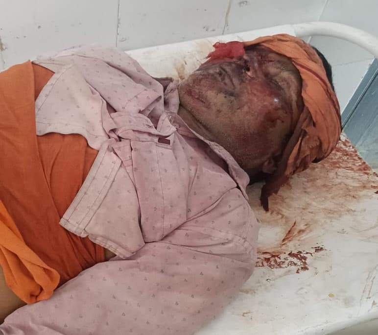 वाहन की टक्कर से अधेड़ की मौत, उग्र भीड़ ने किया सड़क जाम