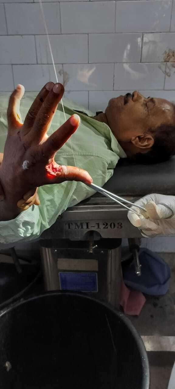 सांड ने आठ लोगों को किया घायल