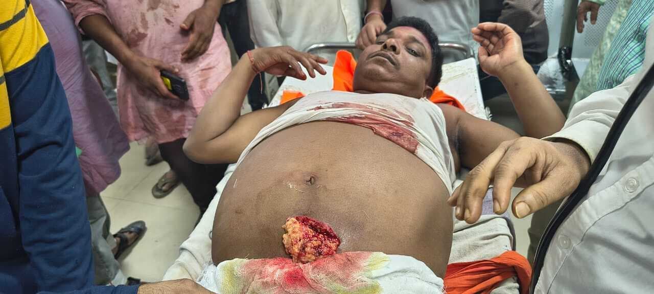 भाजपा नेता को मारा पेट में चाकू, हालत गंभीर