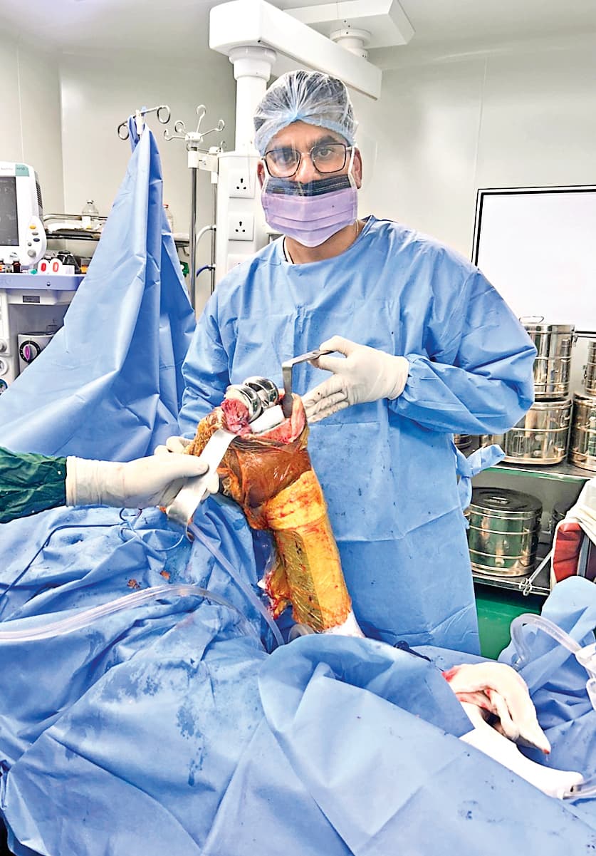 Ranchi News : सदर अस्पताल में पहली बार स्पाइन की सर्जरी