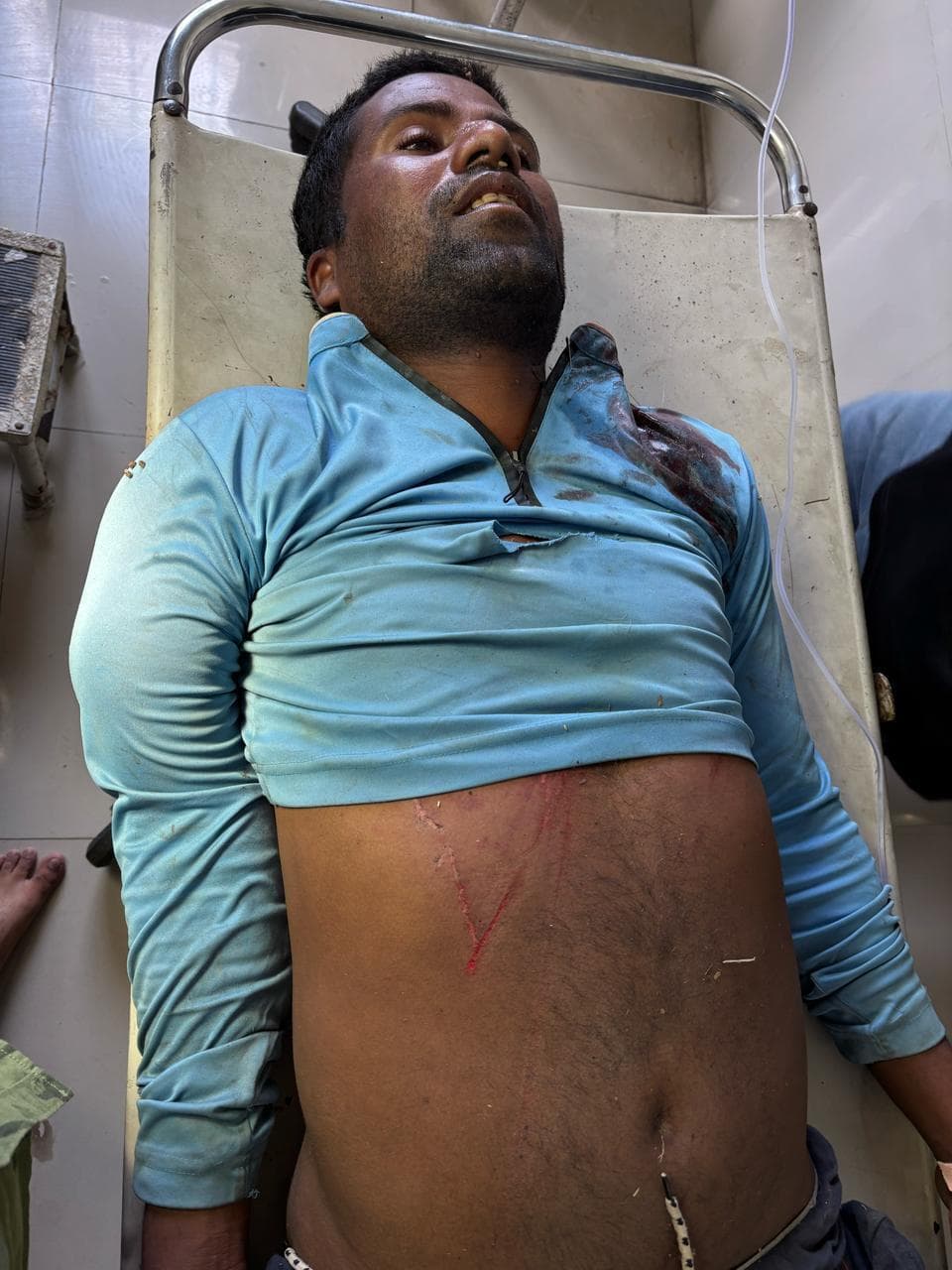 फंदे से लटका युवक, स्थिति गंभीर