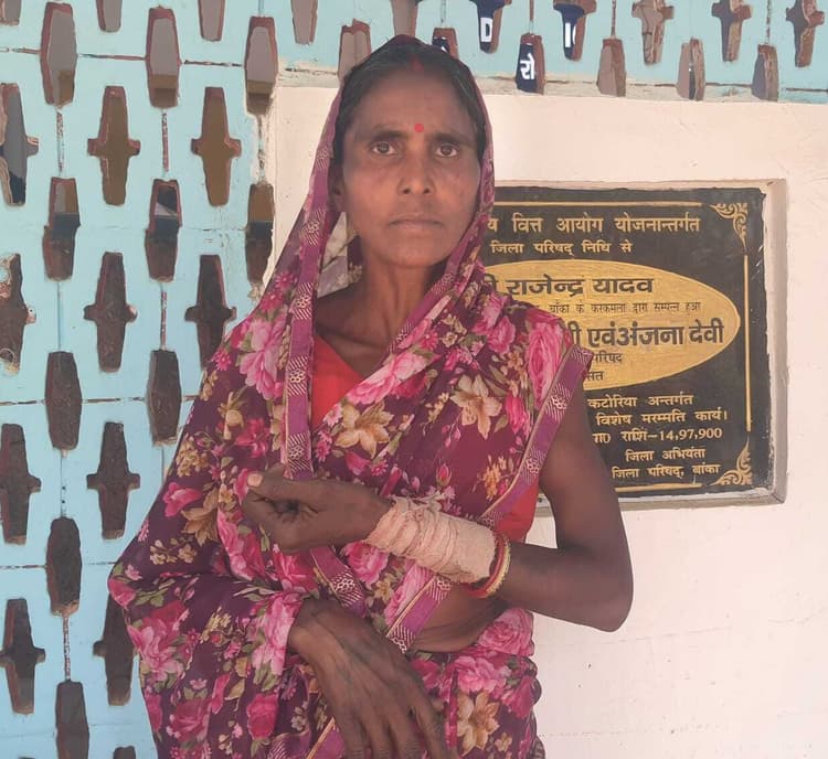 बच्चों के झगड़े में छोटी गोतनी ने मारपीट कर किया घायल