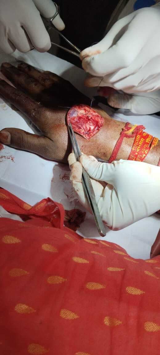 Ranchi News : रामनवमी शोभायात्रा के दौरान कई लोग जख्मी