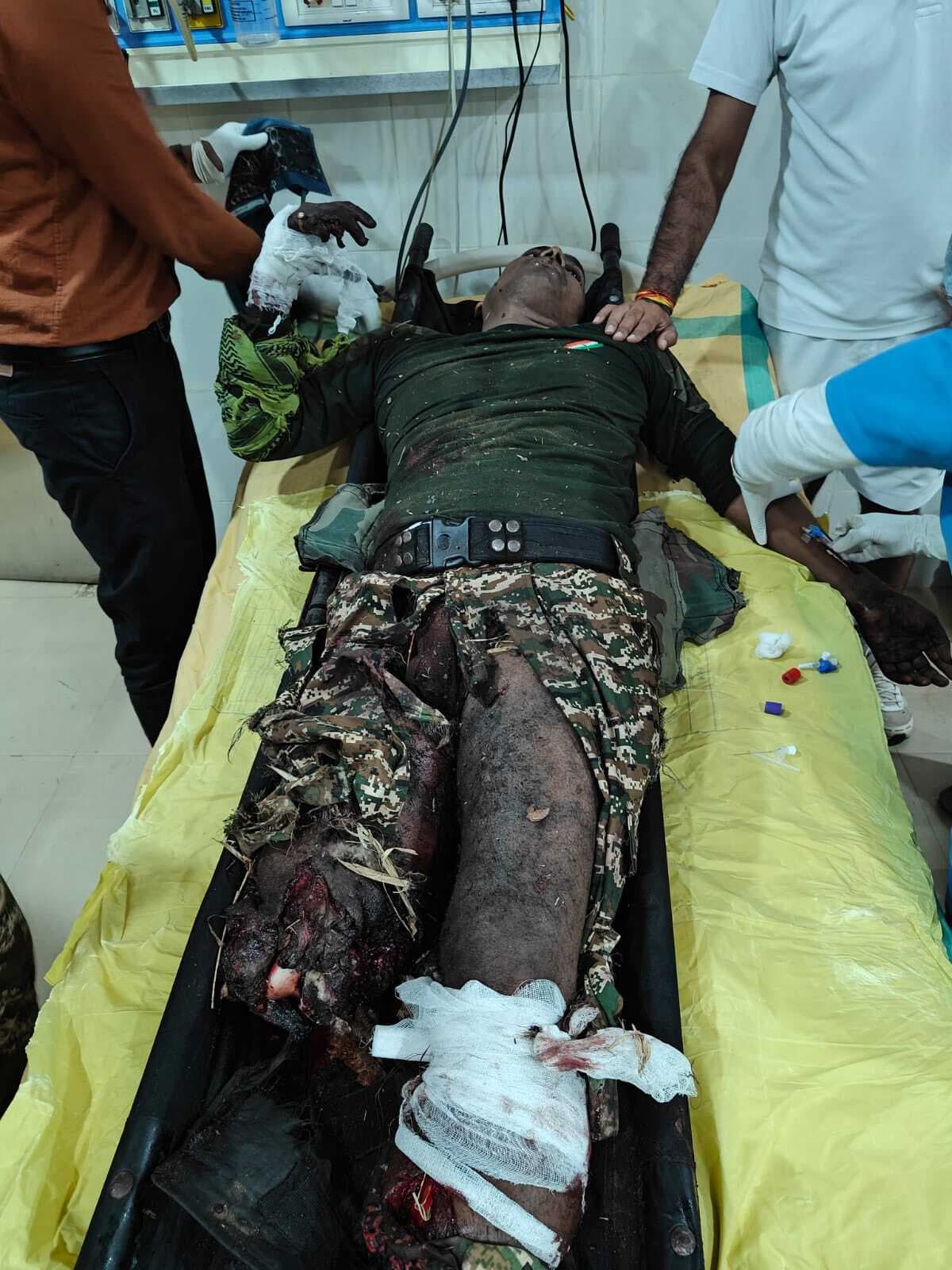 Sasaram News : छत्तीसगढ़ में प्रेशर बम विस्फोट होने से चेनारी का सीआरपीएफ जवान घायल