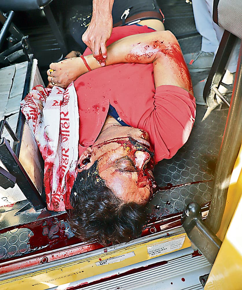 Ranchi News : कोकर में ही करनी थी हत्या, मौका नहीं मिला तो कांके में मारी गोली