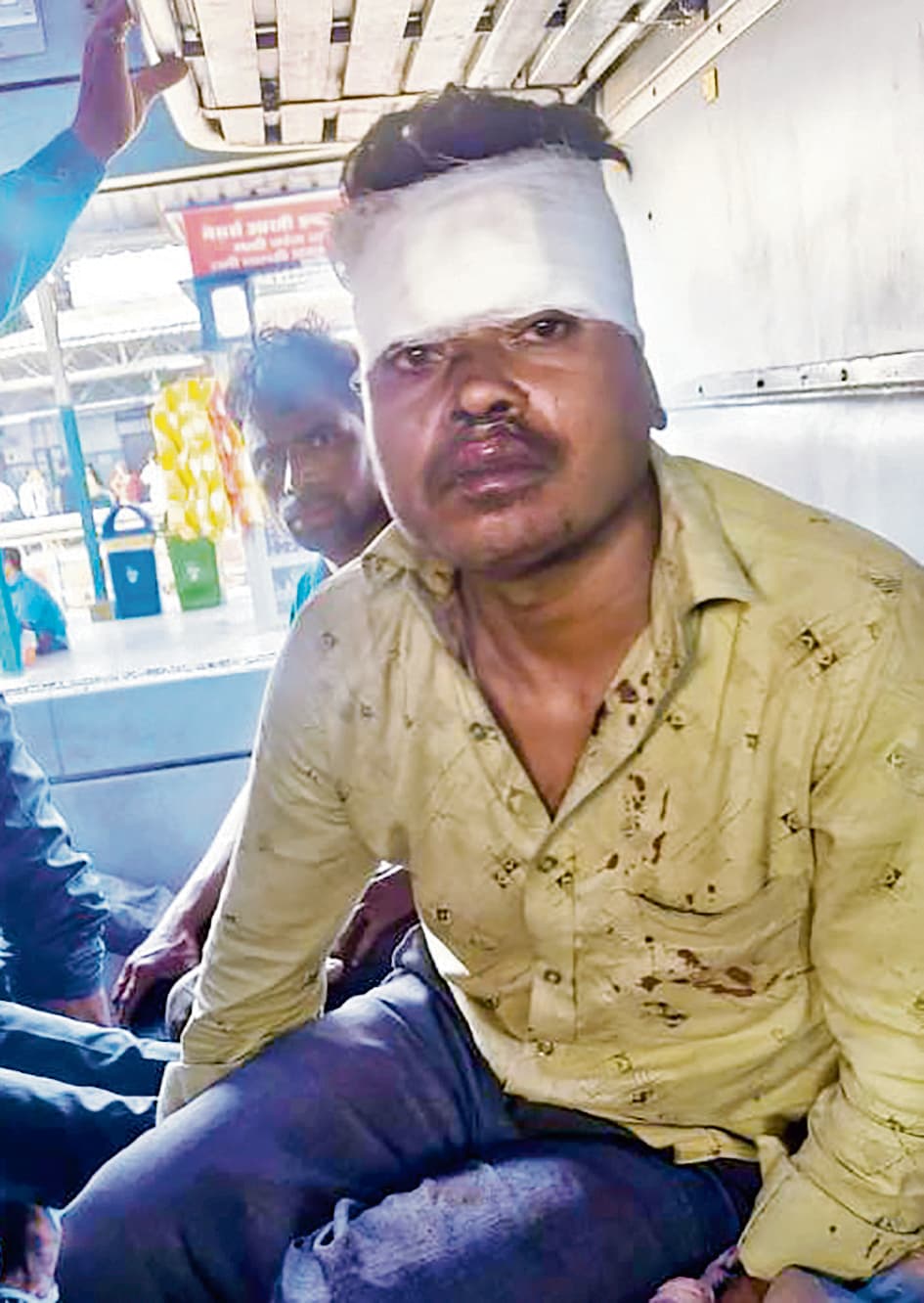 Saran News : एकमा में जनसेवा एक्सप्रेस पर पत्थरबाजी में एक यात्री गंभीर रूप से घायल