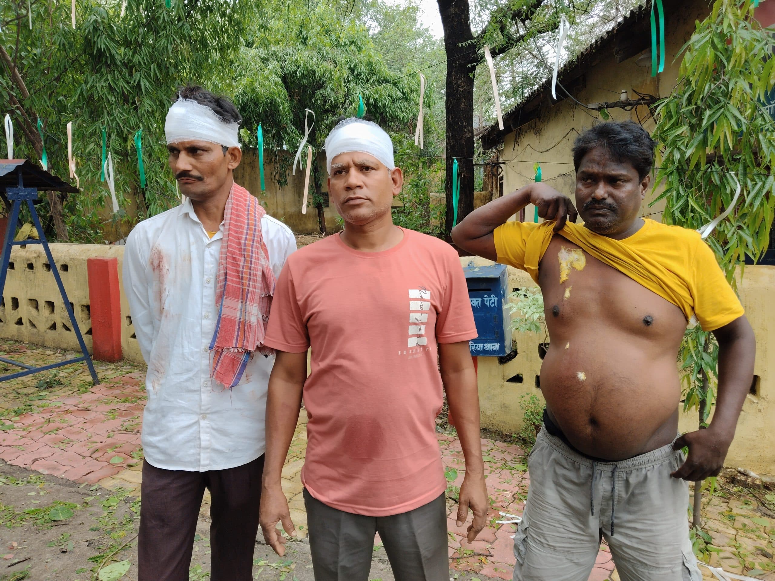 Dhanbad News : झरिया में छींटाकशी को ले दो पक्षों में जमकर मारपीट, कई घायल