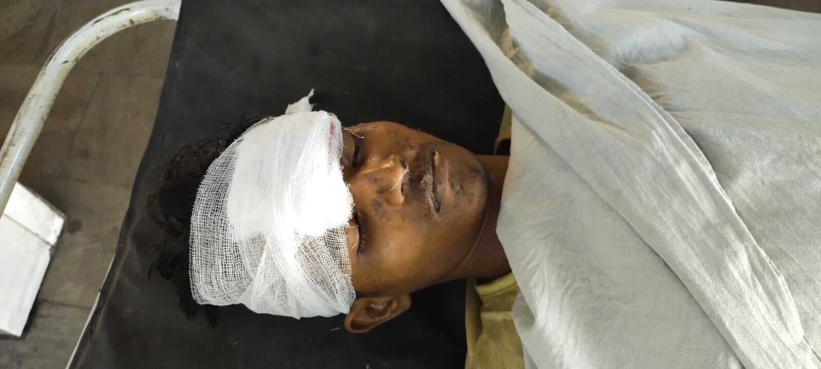 Bokaro News : रील बनाने के दौरान ऊंचाई से गिरकर किशोर की मौत