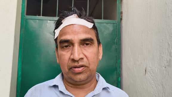 बीआरसी कार्यालय भवन की टूटी छत, आदेशपाल घायल
