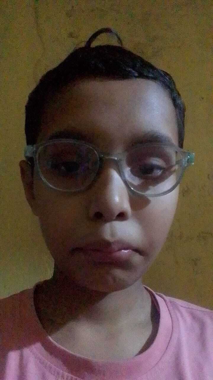 10 वर्षीय बालक को दे दी एक्सपायरी दवा