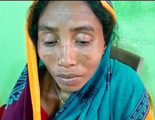 महिला ने ससुराल वालों पर लगाया मारपीट करने का आरोप