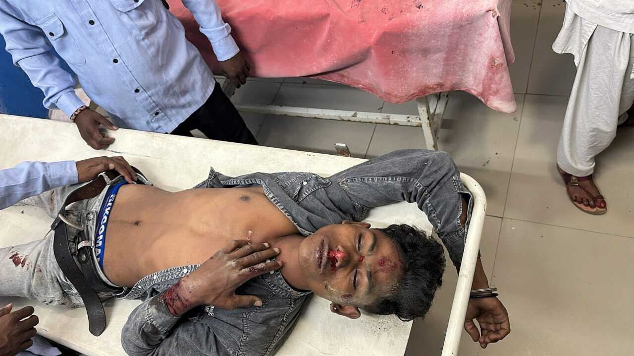 दो बाइकों की आमने-सामने टक्कर में दो गंभीर