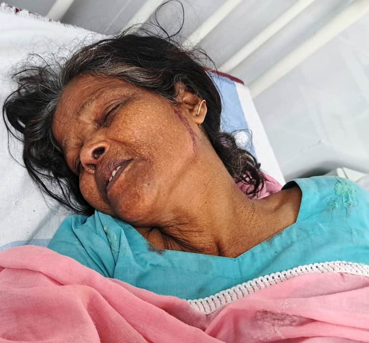 कलयुगी बेटों ने मां का फोड़ा सिर, बीच-बचाव में बहन-जीजा को भी को पीटा