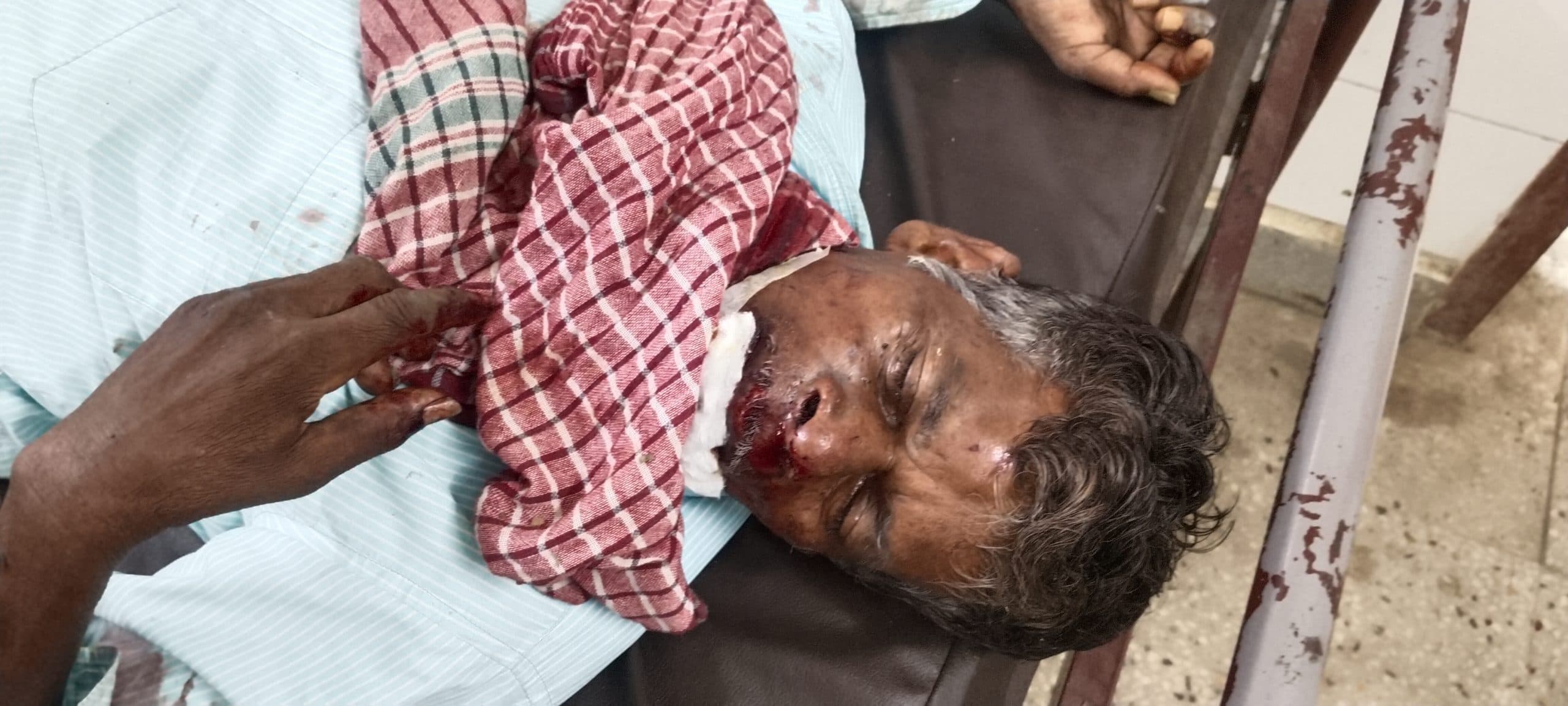 सड़क हादसे में एक व्यक्ति गंभीर रूप से घायल