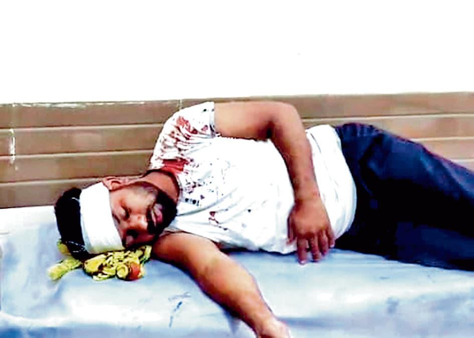 जामुड़िया में आपसी झगड़े में युवक पर हमला, हालत गंभीर