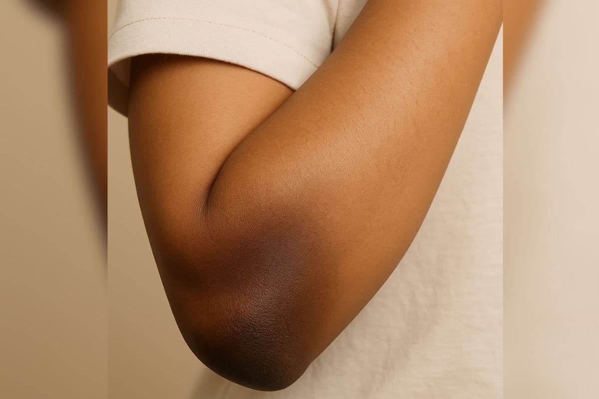 dark elbow dark elbow