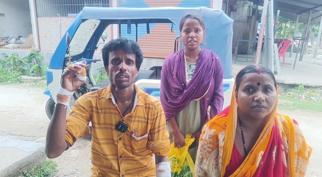 किराया मांगा तो युवती ने चाकू से ई-रिक्शा चालक पर कर दिया हमला, गिरफ्तार