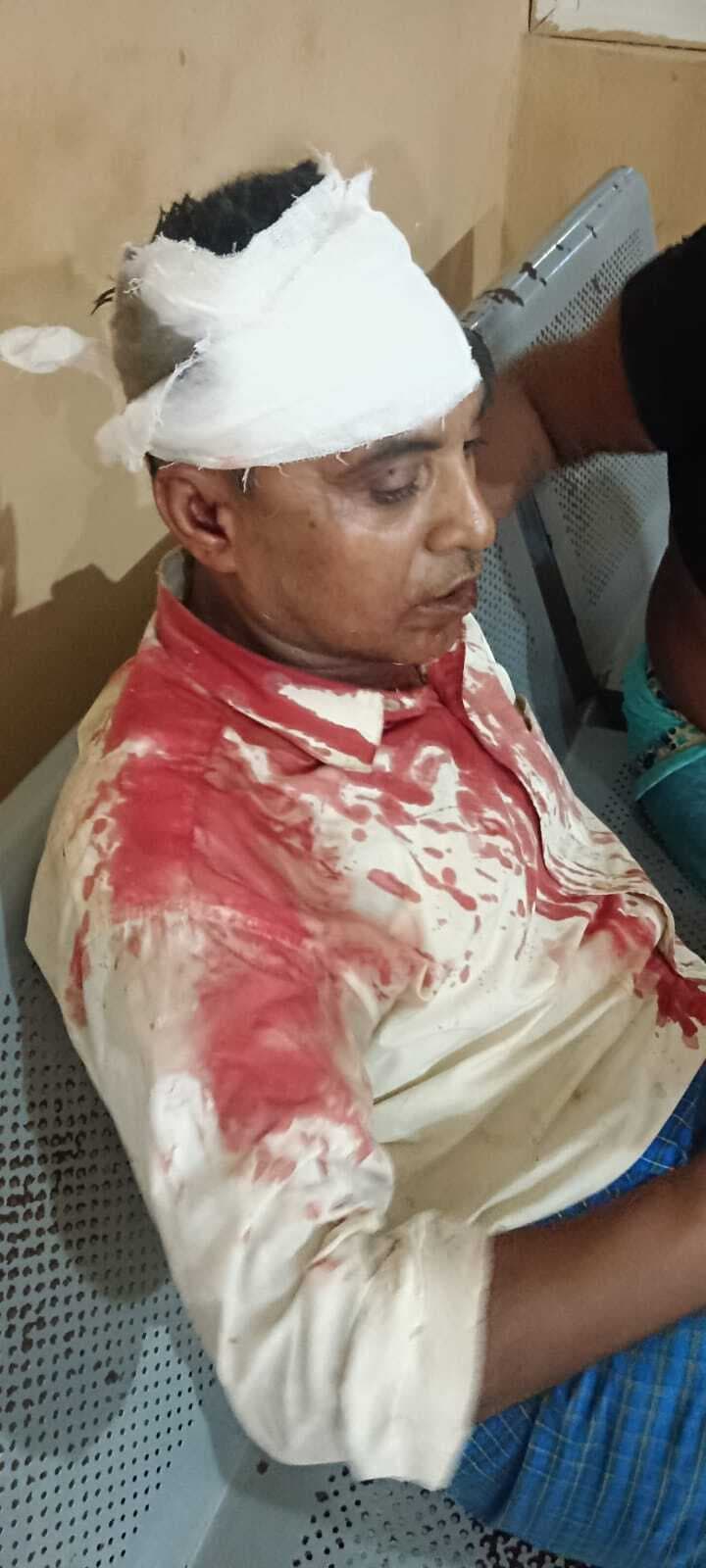 पुरानी रंजिश को लेकर बड़ी चक में तीन लोगों पर किया तलवार से हमला, प्राथमिकी