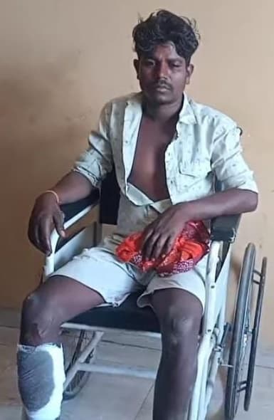 बदमाशों ने मजदूर को मारी गोली, घायल