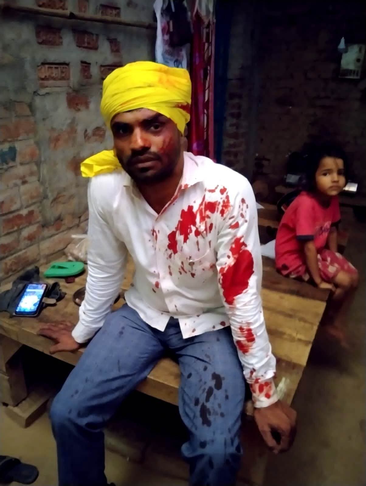 आपसी विवाद में मारपीट, नंदोसी व सरहज जख्मी