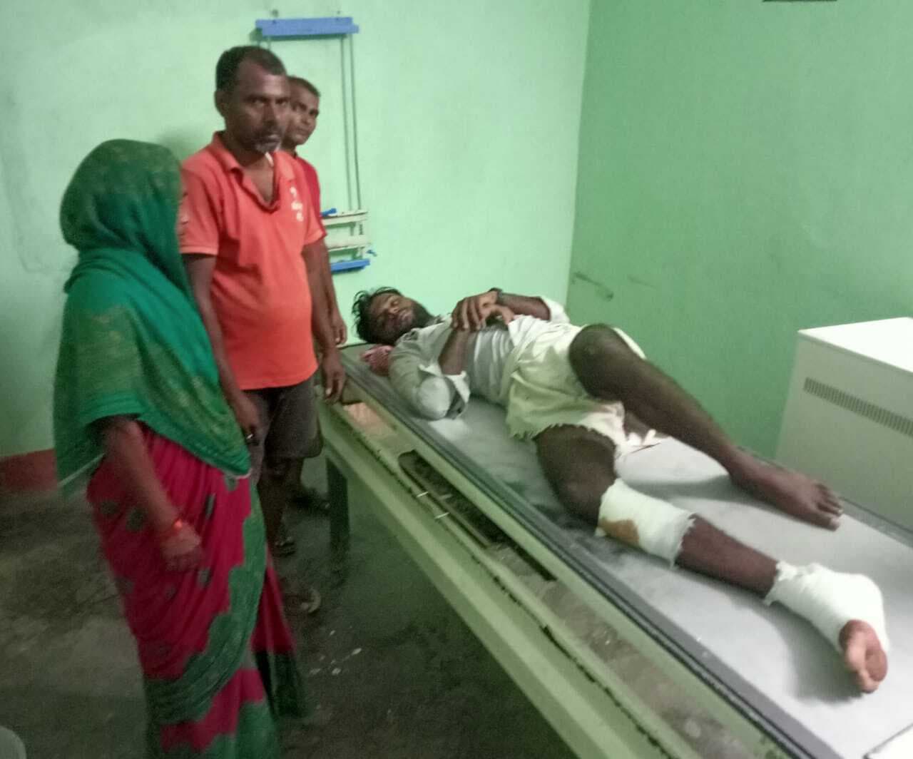 बालू लदी जुगाड़ गाड़ी के धक्के से युवक का टूटा पैर, भागलपुर रेफर