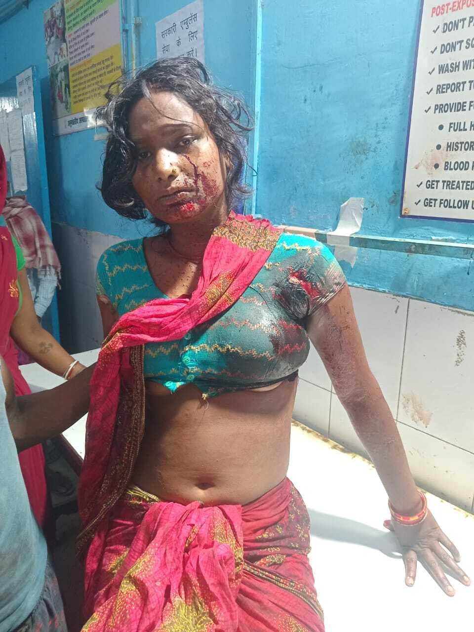 घर में घुसकर पति के सामने विवाहिता को मारी गोली, हालत गंभीर