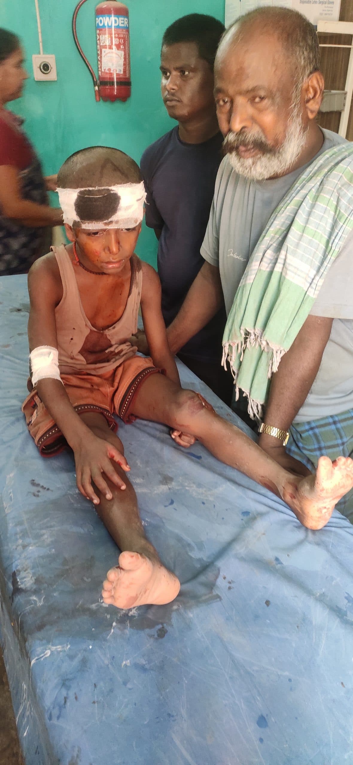 बाइक की ठोकर से बालक की स्थिति नाजुक, रेफर