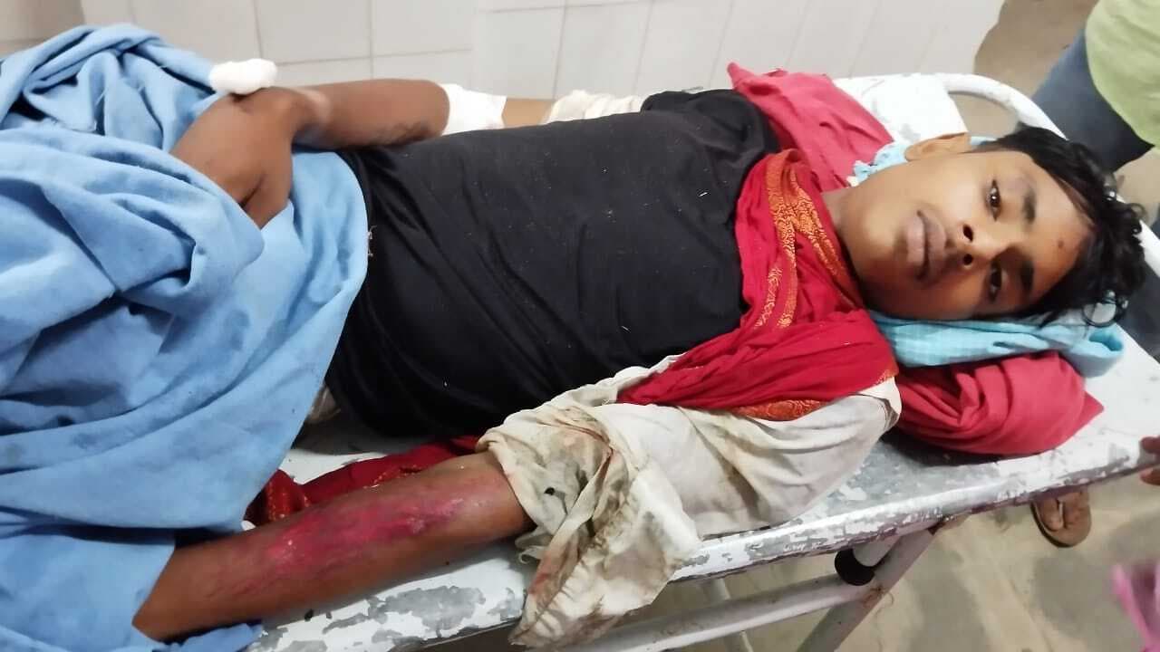 ट्रैक्टर व बाइक की टक्कर में दो युवक घायल, भागलपुर रेफर