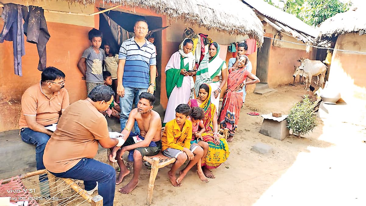 Jamshedpur News : पटमदा में फैला चिकनपॉक्स, जांच में 21 मिले संक्रमित