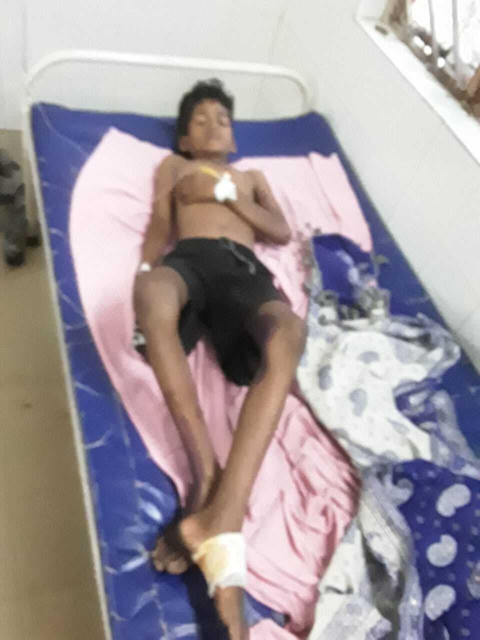 Deoghar news : जामुन तोड़ने के दौरान 11 हजार वोल्ट की चपेट में आये दो सगे भाई, गंभीर रूप से घायल