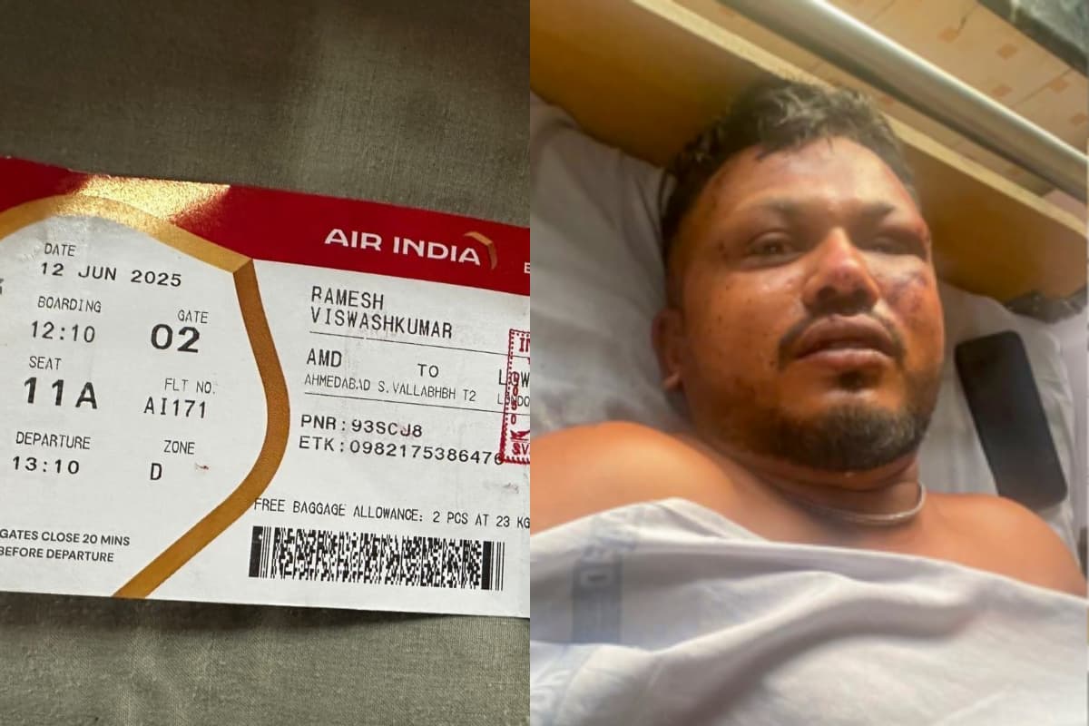 Ahmedabad Plane Crash Survivor Vishwas Kumar Ahmedabad Plane Crash Survivor Vishwas Kumar